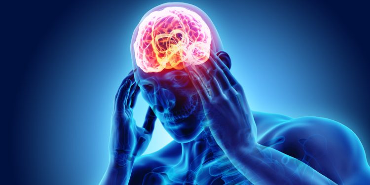 4 Jenis Sakit Migrain, Cara Mengobati dan Mencegahnya