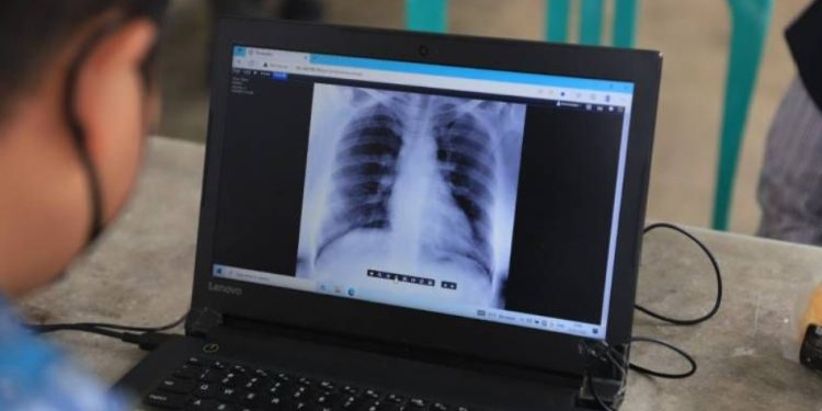 Skrining Stunting dan TBC Menyasar 85 Ribu Balita di Kota Tangerang, Ini Tahapan Pemeriksaannya